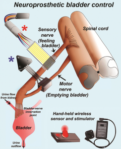 Bladder project