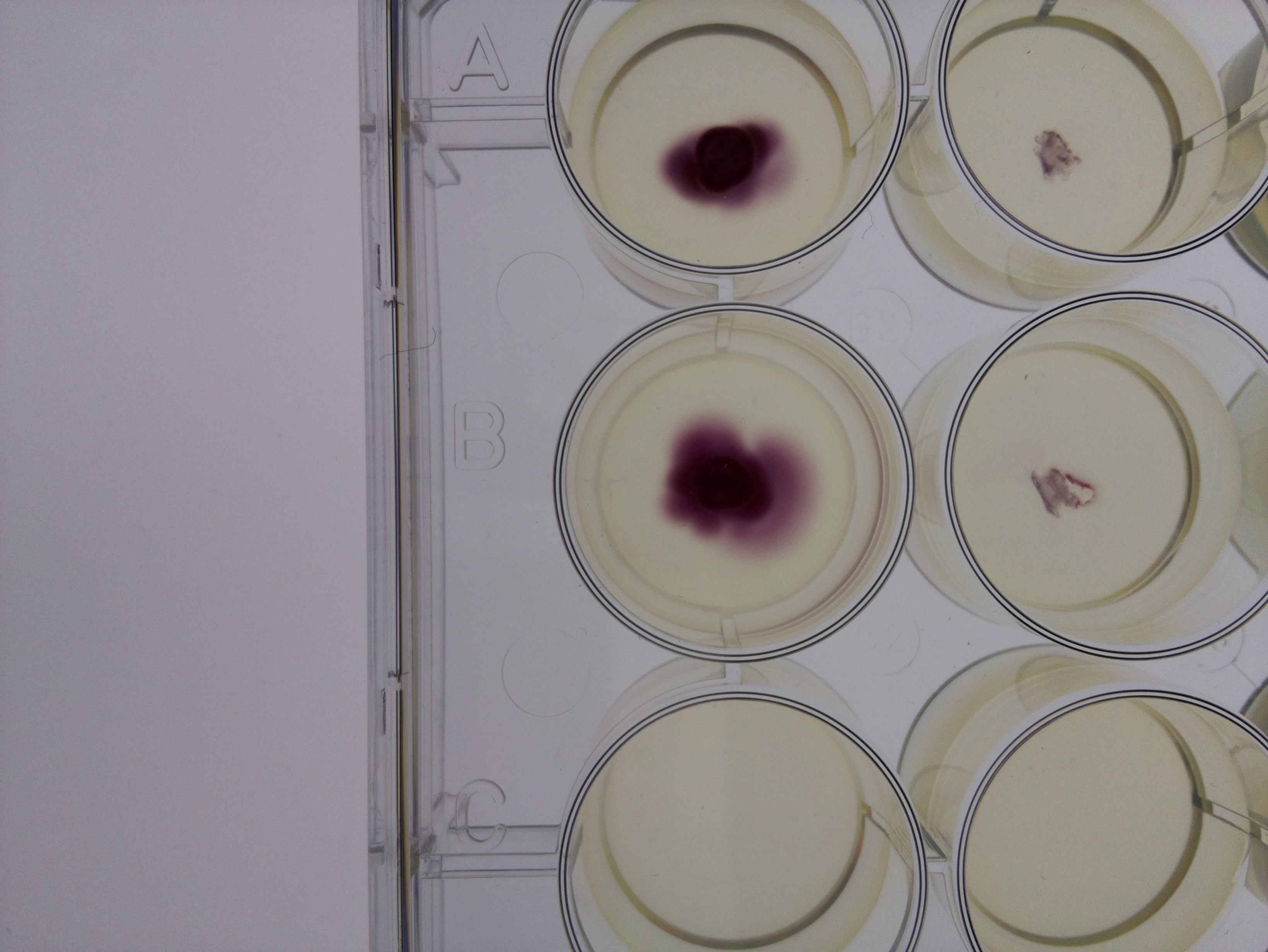 Timelapse of E. coli growth in soft agar captured using a Raspberry Pi Camera