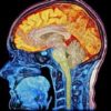 Brain x-ray image