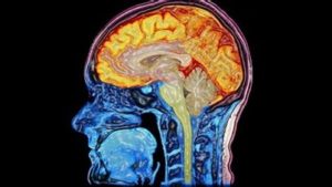 Brain x-ray image