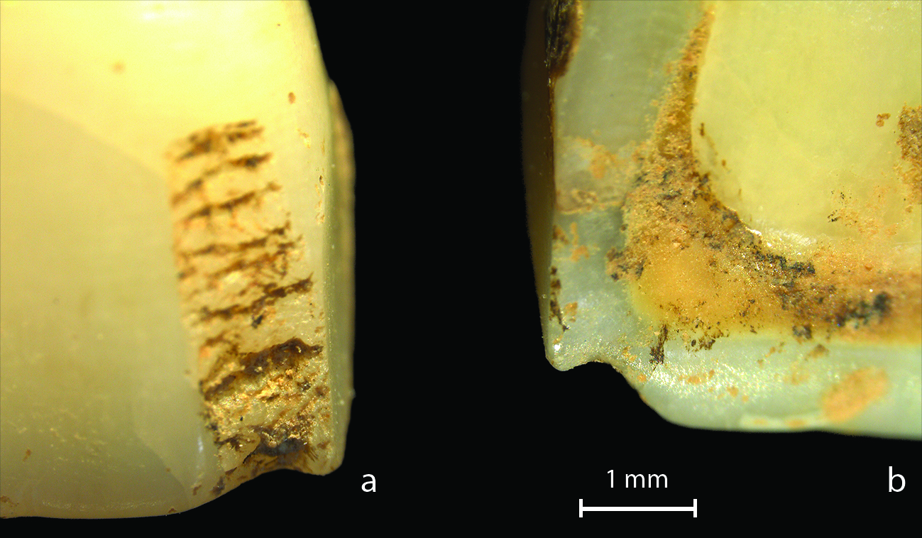 New article on the osteoarchaeology from Bestansur