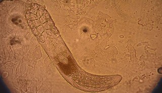 Microscopic image of mite
